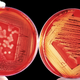Illustration for article titled Scientists are Brewing Medieval Potions to Fight Hospital Superbugs